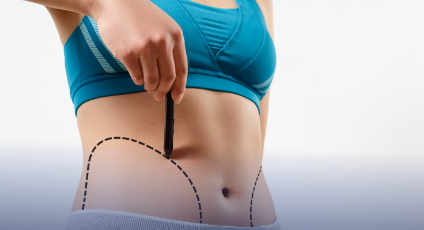 Tummy Tuck Aesthetics